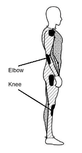 MP-258 Protection Diagram