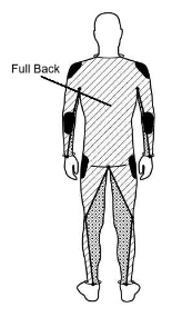 MP-259 Protection Diagram