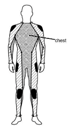 MP-260 Protection Diagram