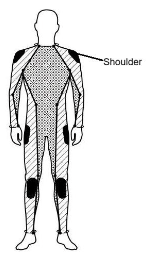 Shoulder Protection Diagram